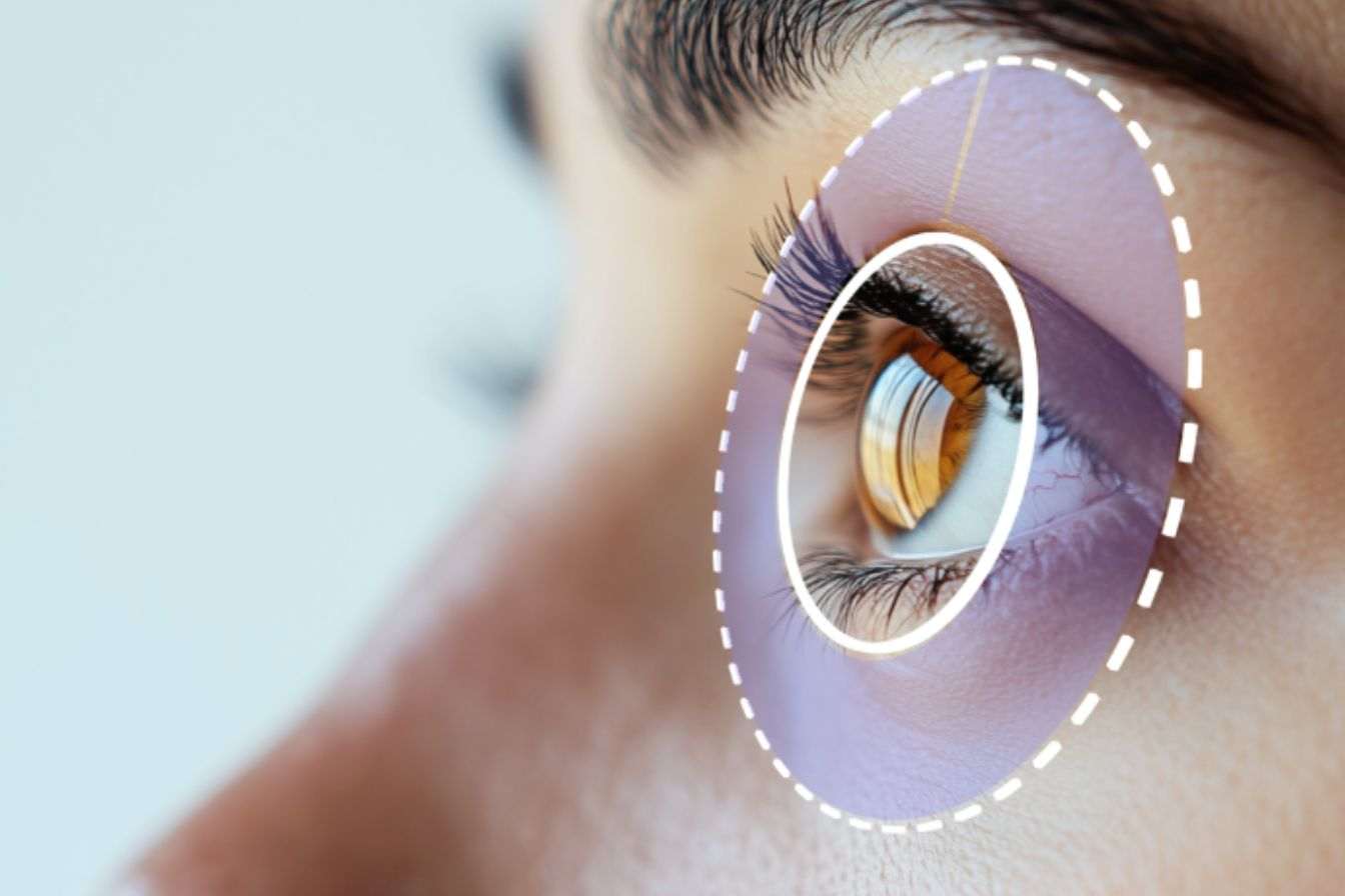 Eyebot 2026